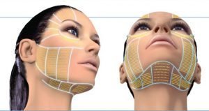 facelift-huidenlaserkliniekzeeland
