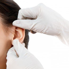 oorcorrectie-huidenlaserkliniekzeeland