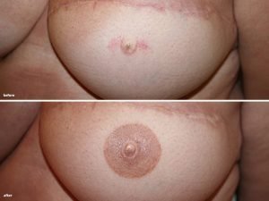 permanente-make-up-huidenlaserkliniekzeeland7